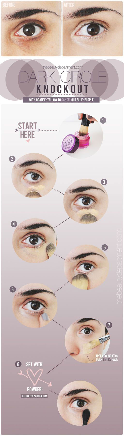 15 Ways to Get Rid of Dark Circles Under Your Eyes