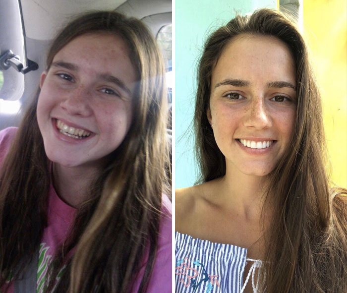 15 To 23. No Makeup For A Better Comparison